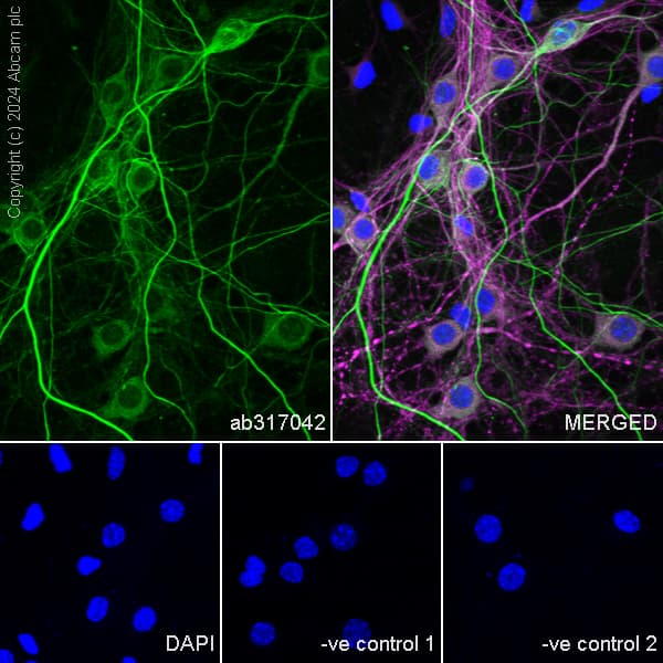 Anti-NEFH antibody [EPR20020] - Chicken IgY (Chimeric) - BSA and Azide free(AB317043)