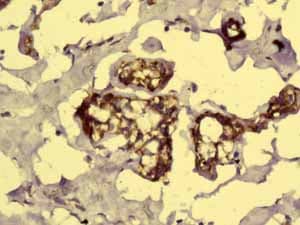 Gc1q R Antibody Epr8870 Ab134926  Immunohistochemistry Formalin Pfa Fixed Paraffin Embedded Sections Img122516