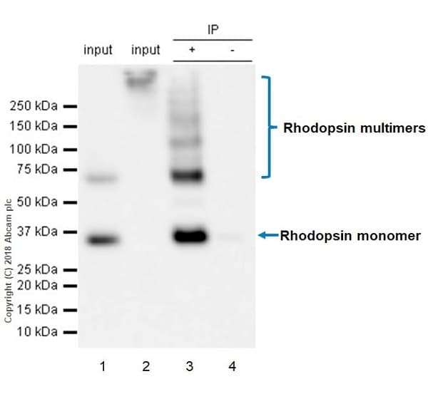 Anti-Rhodopsin antibody [EPR21876](AB221664)