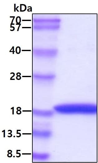 Recombinant human Interferon alpha 1 protein (Active)(AB48750)
