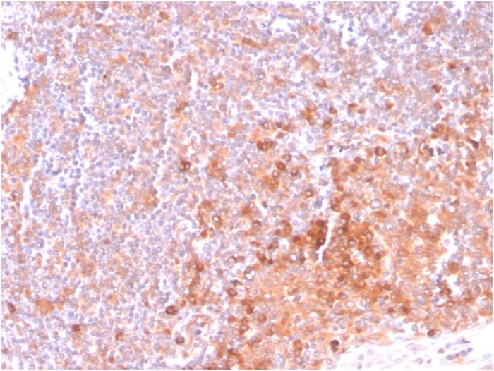 Cd134 Ox40l Receptor Antibody Ox40 3108 Ab270727  Immunohistochemistry Formalin Pfa Fixed Paraffin Embedded Sections Img96368