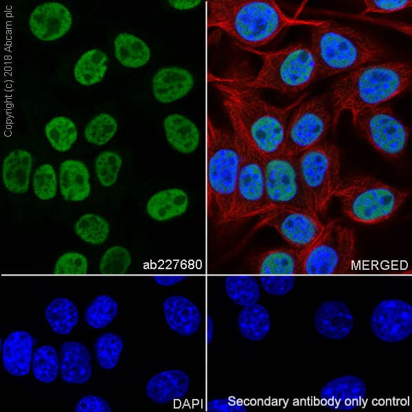 Mature Oligodendrocyte Marker (Olig2, MBP, MOG, SOX10) Antibody Sampler Panel - Human, Mouse(AB254026)