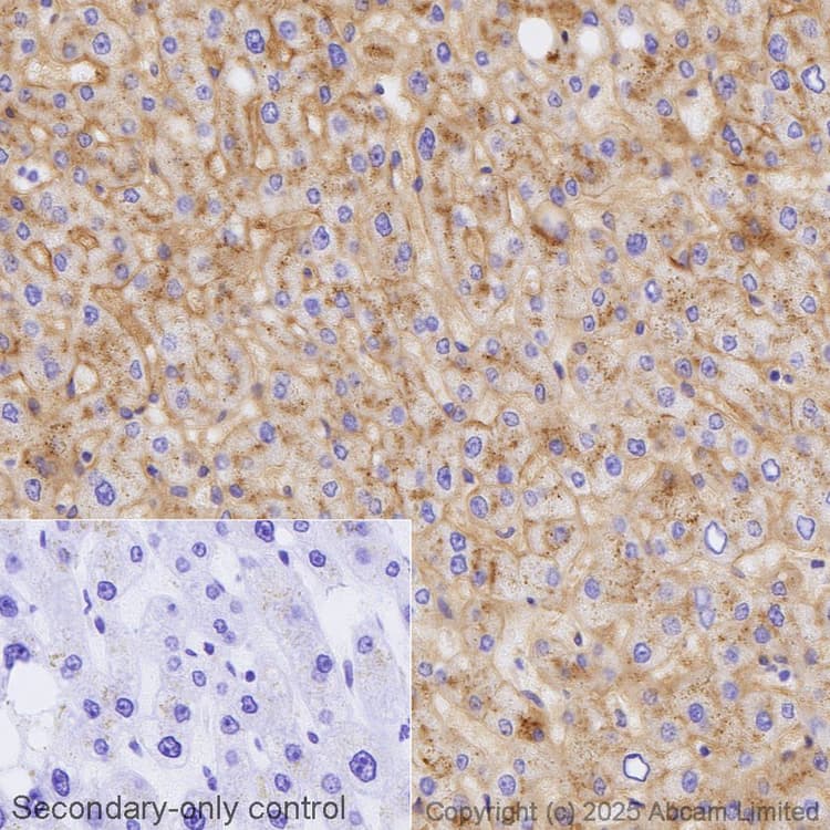 Avidin/Biotin Blocking Kit(ab64212)