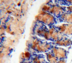 Ccl28 Mec Antibody Ab232837  Immunohistochemistry Formalin Pfa Fixed Paraffin Embedded Sections Img114453