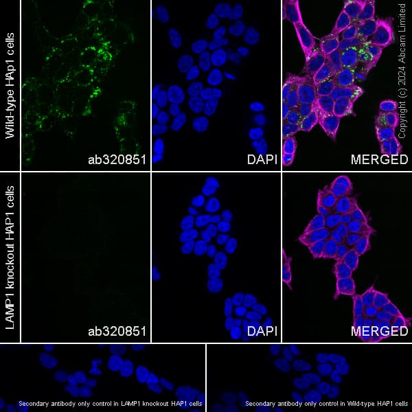 Anti-LAMP1 antibody [RM1217](AB320851)