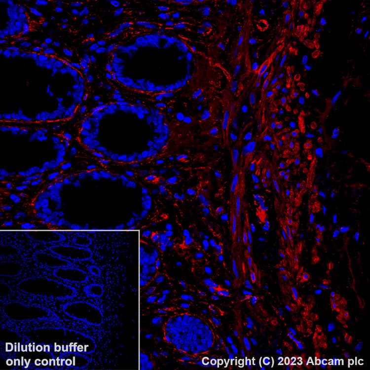 Alexa Fluor® 647 Anti-Fibronectin antibody [EPR23110-46](AB313350)