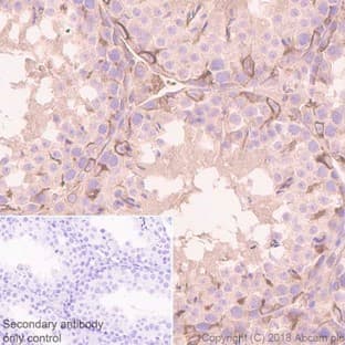 Anti-pan Cadherin antibody [EPR1792Y] - Intercellular Junction Marker(AB51034)