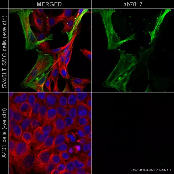 Anti-alpha smooth muscle Actin antibody [1A4](AB7817)