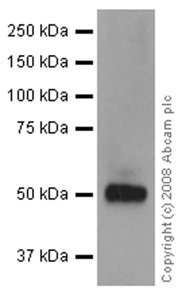 Vitamin D Binding Protein Antibody Ep2923y Ab81307  Western Blot Img154055