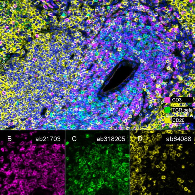 Anti-CD20 antibody [SP32](ab64088)