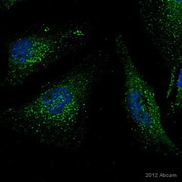 Anti-VPS35 antibody(AB10099)