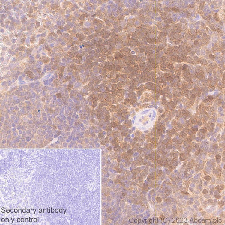 Anti-TMS1/ASC antibody [RM1049](AB309497)
