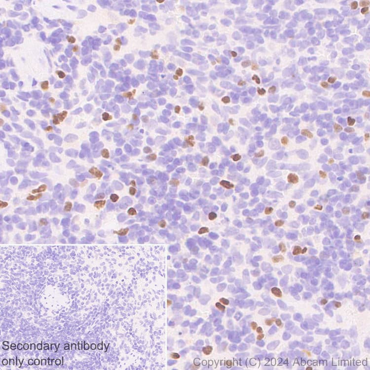 Anti-TBR2 / Eomes antibody [RM2055](AB319166)