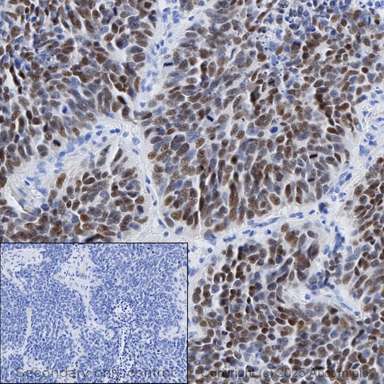 Anti-MASH1/Achaete-scute homolog 1 antibody [EPR19840](AB211327)