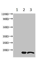 Anti-TTC11/FIS1 antibody(ab229969)