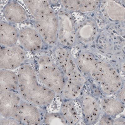 Anti-NIFK antibody [CL2240] - Nucleolar Marker(AB211871)