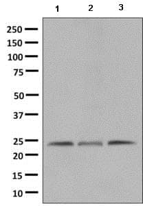 Mrps15 Antibody Epr9361 Ab137070  Western Blot Img16807