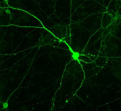 Anti-Tyrosine Hydroxylase antibody(AB6211)