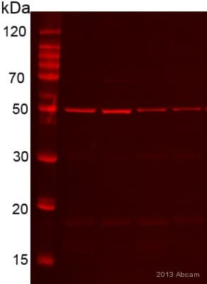 Anti-Desmin antibody [Y66] - Cytoskeleton Marker(AB32362)