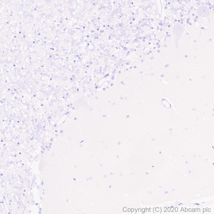 Casr Antibody Epr24050 59 Bsa And Azide Free Ab280360  Immunohistochemistry Formalin Pfa Fixed Paraffin Embedded Sections Img4141
