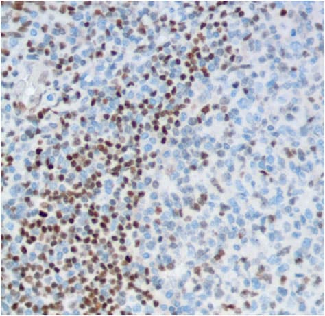 Anti-FOXP1 antibody [SP133] - C-terminal(AB227649)