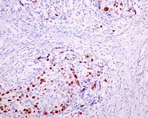 Nucleolin Phospho T76 Antibody Epr8080 2 Ab168363  Immunohistochemistry Formalin Pfa Fixed Paraffin Embedded Sections Img135438