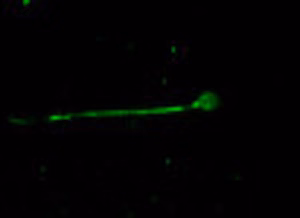 Nav18 Scn10a Antibody Ab66743 Immunocytochemistry Img1074