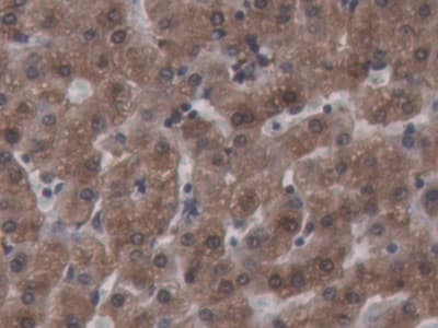 Anti-Ferritin Heavy Chain antibody(AB231253)