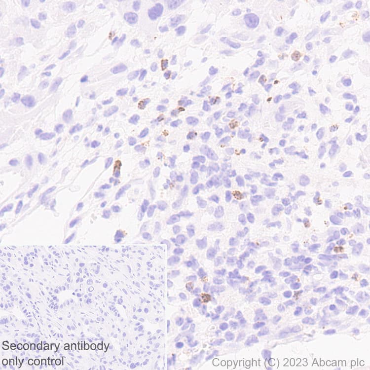 Anti-Neutrophil Elastase antibody [EPR28386-66](AB310335)