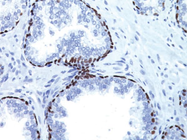 Anti-p63 antibody [4A4](AB735)