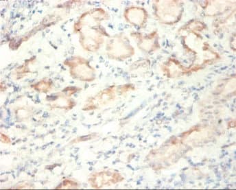 Anti-SDHA antibody(AB235594)