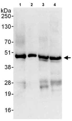 Anti-YB1 antibody(AB225706)