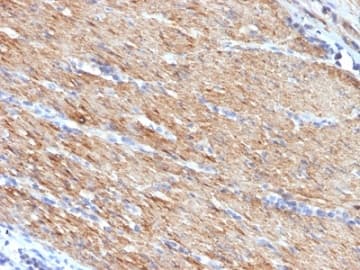 Smooth Muscle Myosin Heavy Chain I Antibody Myh11 923 Ab233940  Immunohistochemistry Formalin Pfa Fixed Paraffin Embedded Sections Img132303