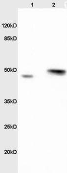 Anti-Ribonuclease Inhibitor/RAI antibody(AB203658)