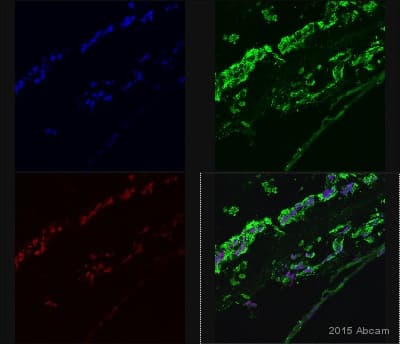 Anti-NF-kB p65 antibody(AB16502)