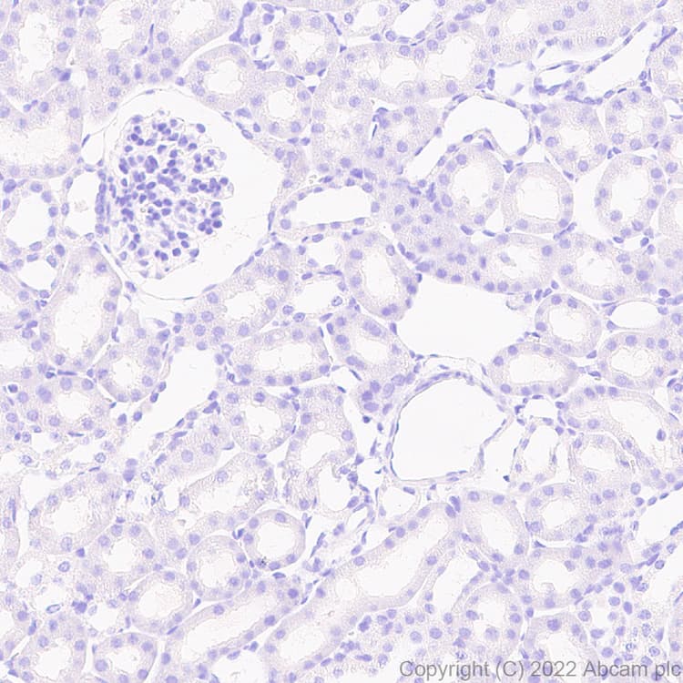 Anti-Calcineurin B/PPP3R1 antibody [EPR24992-18](AB303482)