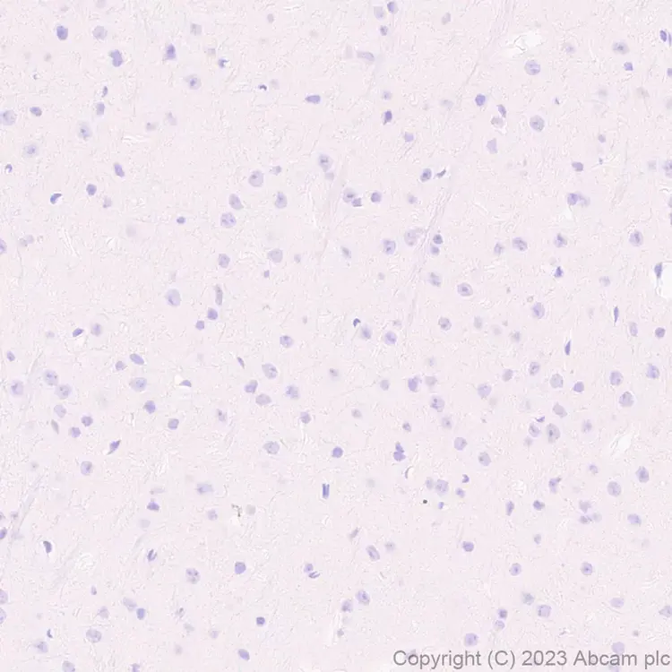 Anti-Streptococcus mutans Cell surface antigen I/II antibody [EPR28235-11](AB316006)