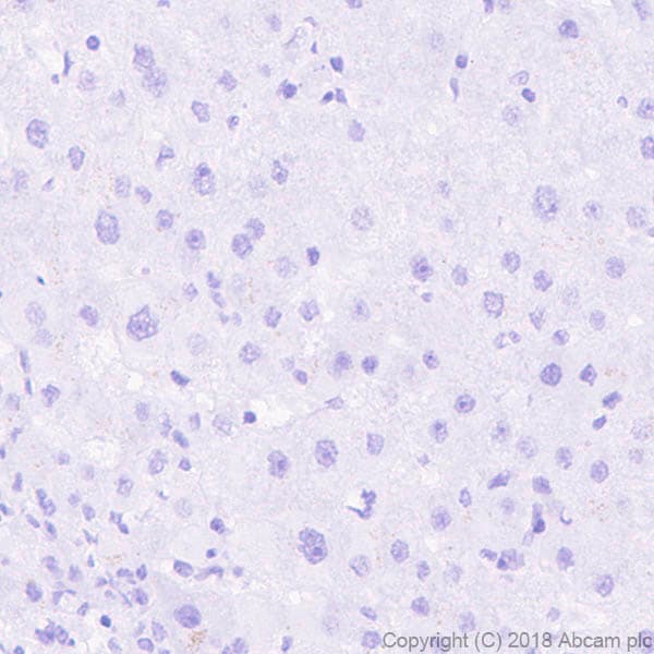 Anti-VGluT1 antibody [EPR22269](ab227805)