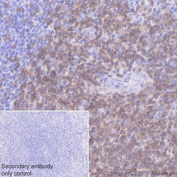 Cd3d Antibody Epr20544 Bsa And Azide Free Ab229280  Immunohistochemistry Formalin Pfa Fixed Paraffin Embedded Sections Img106694