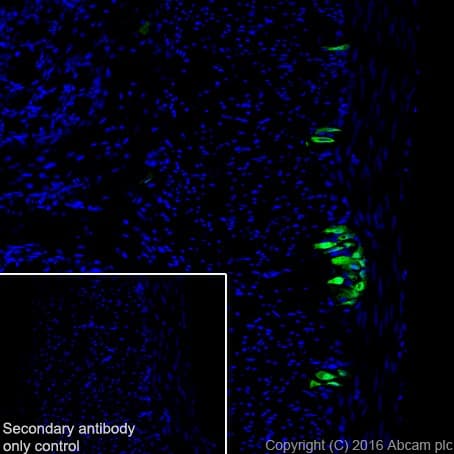 Anti-HuD + HuC antibody [EPR19098](AB184267)