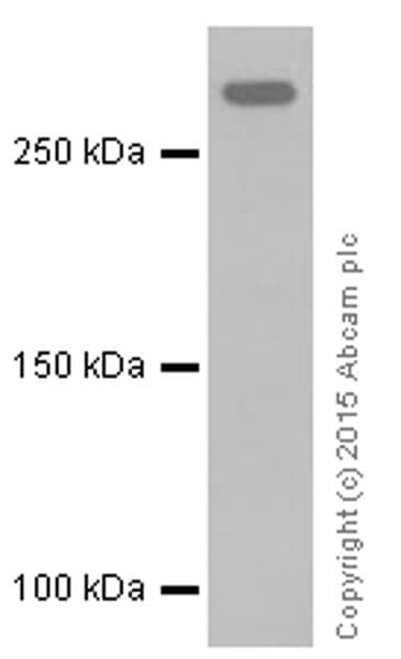 Anti-ATM (phospho S1981) antibody [EP1890Y] - BSA and Azide free(AB208775)