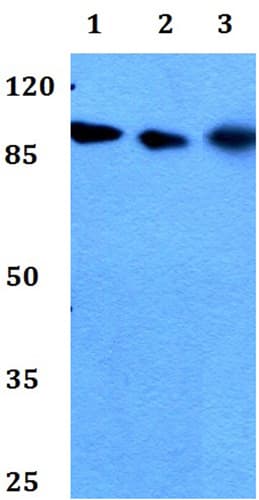 Anti-MCM8 antibody(AB191914)