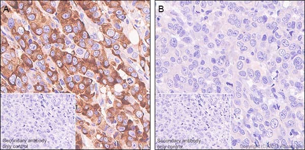 Rps6 Phospho S240 S244 Antibody Sp45 Ab81081  Immunohistochemistry Formalin Pfa Fixed Paraffin Embedded Sections Img117469