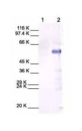 Anti-MMP13 antibody(AB39012)