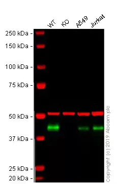 Anti-HLA A antibody [EP1395Y](AB52922)