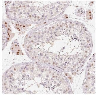 Arhgap22 Antibody Ab204743  Immunohistochemistry Formalin Pfa Fixed Paraffin Embedded Sections Img81193