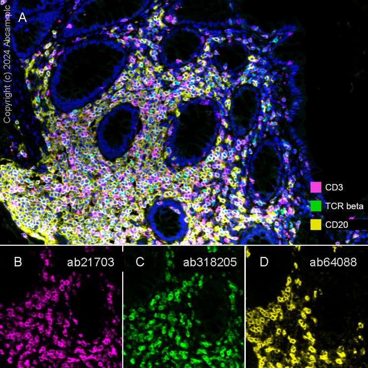 Anti-CD20 antibody [SP32](ab64088)