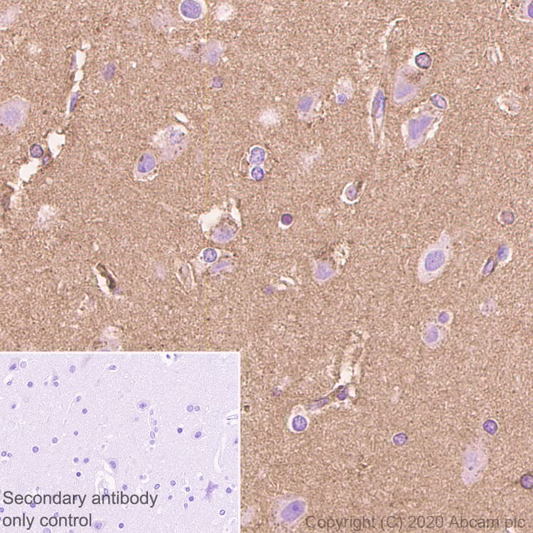 Anti-Apolipoprotein E antibody [EP1374Y](AB52607)
