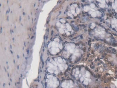 Anti-ACD antibody(AB231330)