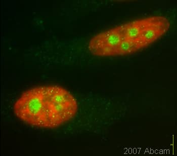 Anti-Smg1 antibody(ab30916)